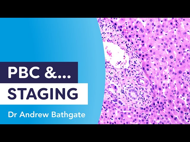 PBC and Staging | Dr Andrew Bathgate