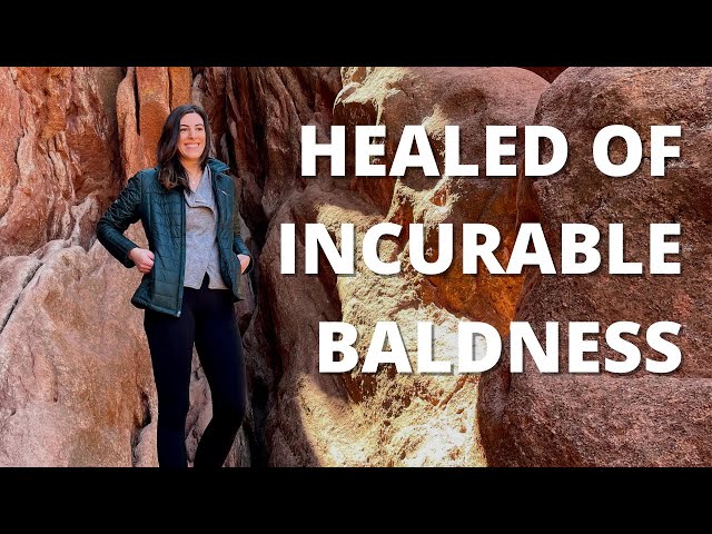 Healed of Alopecia Universalis and Baldness – Allyson Rola