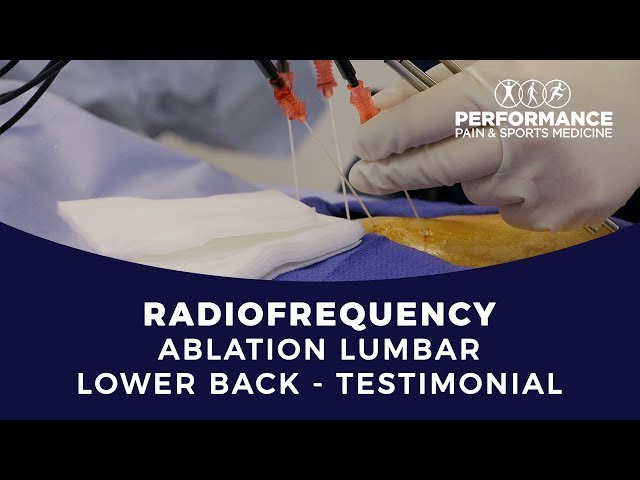 Radiofrequency Ablation Treatment Lumbar Lower Back Pain Houston, TX - Patient Testimonial