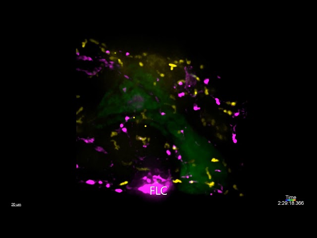 FLC larvae display innate immune cell infiltration in the liver area