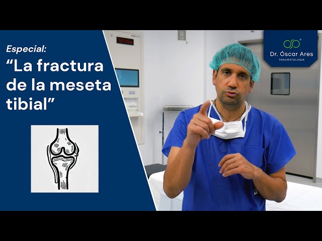 La fractura de la meseta tibial - Dr. Oscar Ares