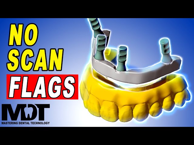 All On 4 Design with Screw Retained Bar Split File [ Exocad Tutorial ]