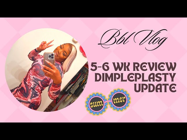 Bbl Vlog 5-6 Wk Review|New Journey|Single|Dimpleplasty Update #bbl #miami #lipo #surgerylife