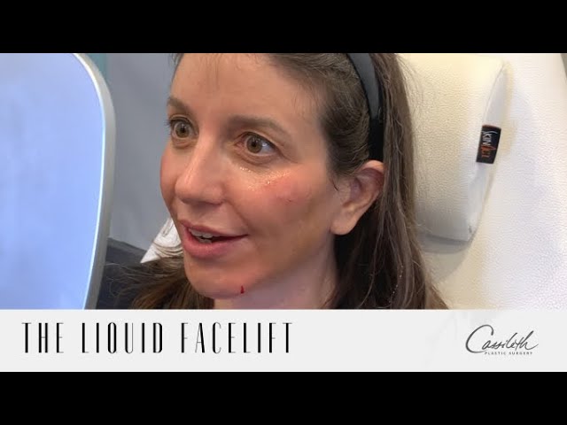 Non-Surgical Facelift | Look Younger And Refreshed Without Going Under The Knife