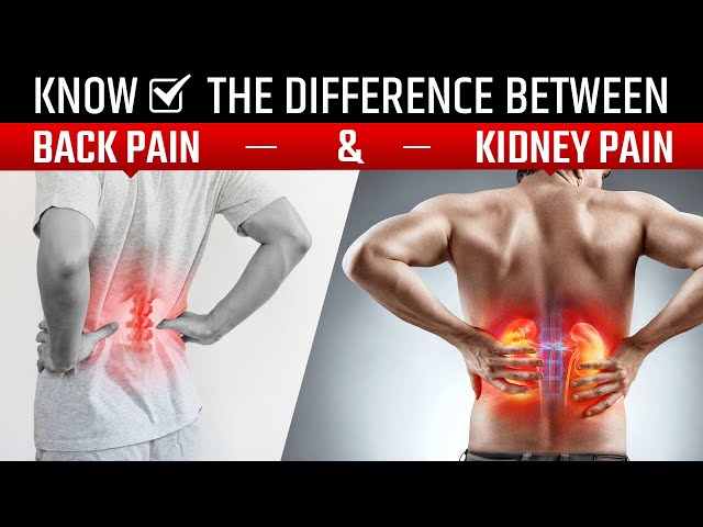 Know the difference between Back Pain and Kidney Pain | Dr Pragti Gupta