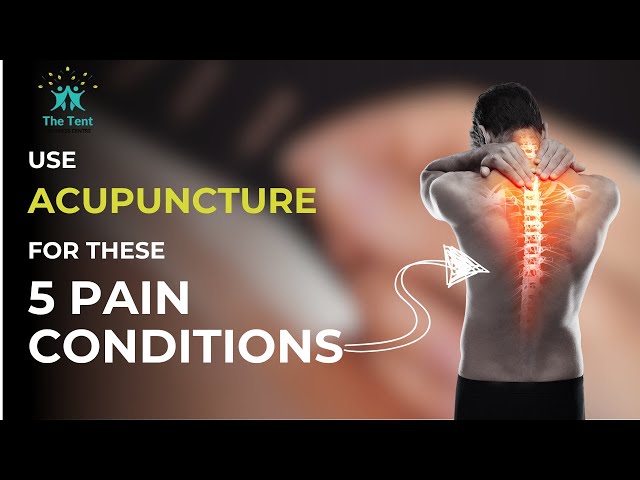 5 Chronic Pain Conditions Acupuncture Can Help Relieve