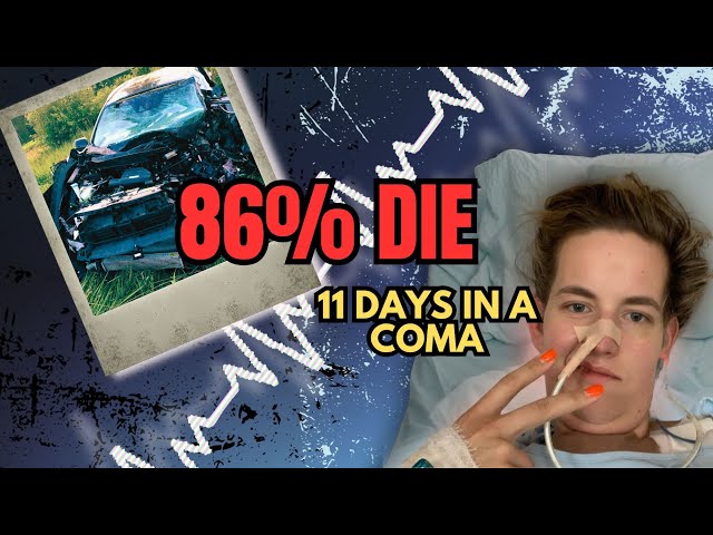 86% Don’t Make It Within 24 Hours | A Coma Survivor Story