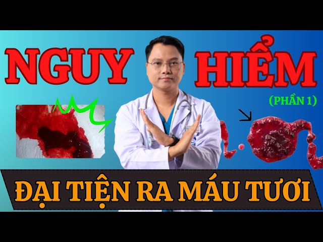 ĐẠI TIỆN RA MÁU TƯƠI Thì Liệu Có NGUY HIỂM HAY KHÔNG? (PHẦN 1) |Dr Cường Offical