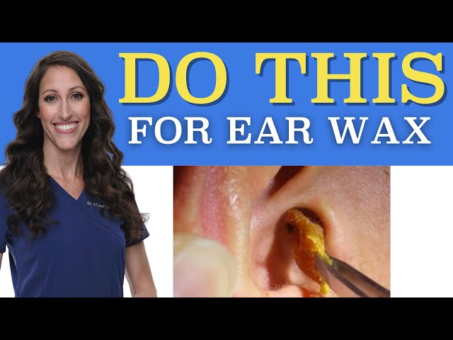 How To Clean Ear Wax Out Of Your Ears | Easy Daily Ear Wax Removal Cleaning Solution