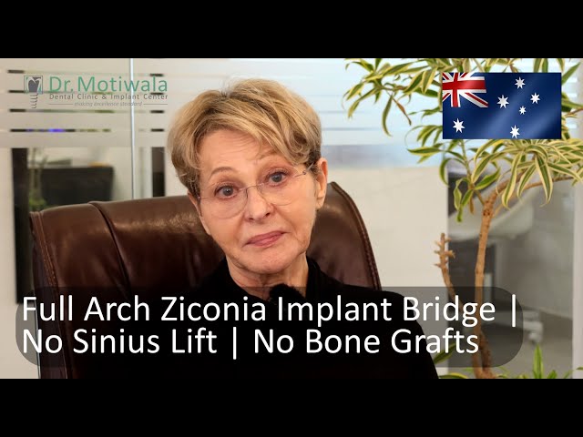 Dental Implant Failure | All on 4