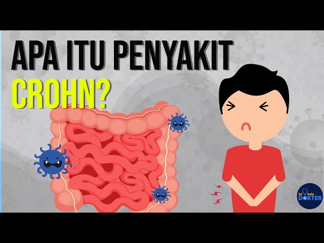 Apa itu Penyakit Crohn?