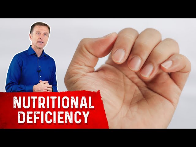 Your Nails Help Diagnose Nutrient Deficiencies