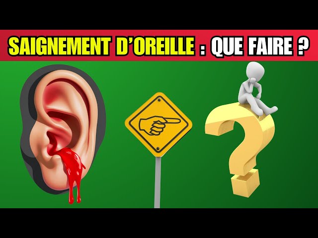 Votre Oreille Saigne après Nettoyage ? Découvrez les DANGERS Cachés ! 🚨👂❗ #Santé #BienÊtre