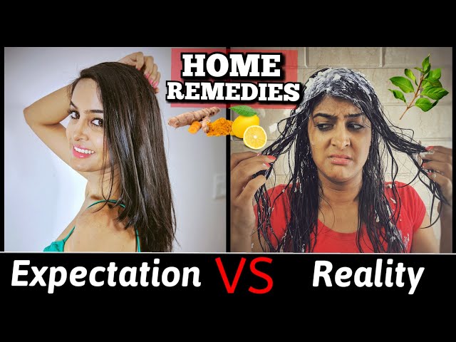 Home Remedies: Expectation VS. Reality | Anisha Dixit | Rickshawali