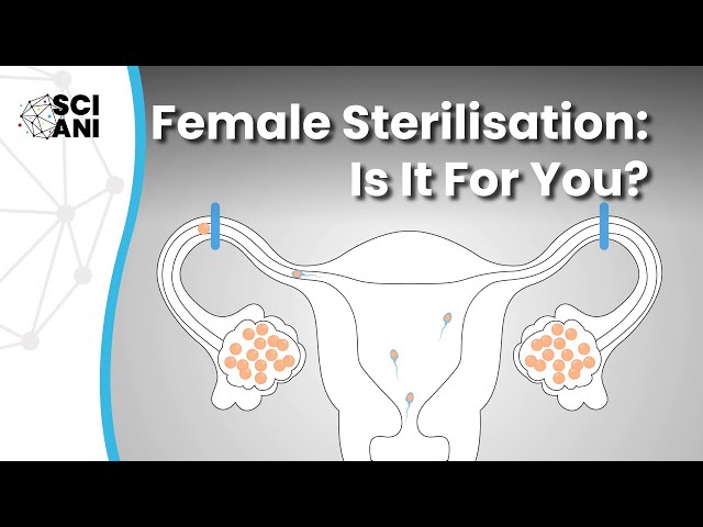 Female sterilisation: Is it for you?