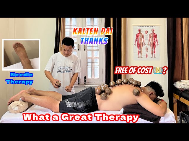 1st Time Experiencing Cupping Therapy | Free Cupping 💵? Kalten Accupuncture @shezontiger1818