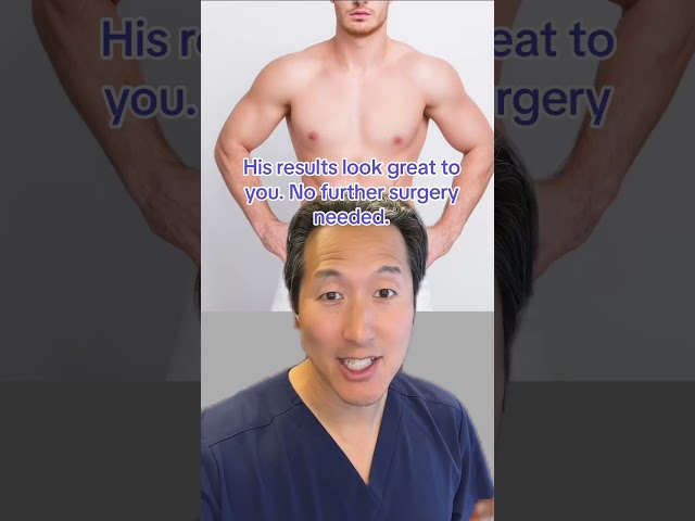 You Are The Plastic Surgeon: Gynecomastia (Manboobs) Edition! #plasticsurgeon