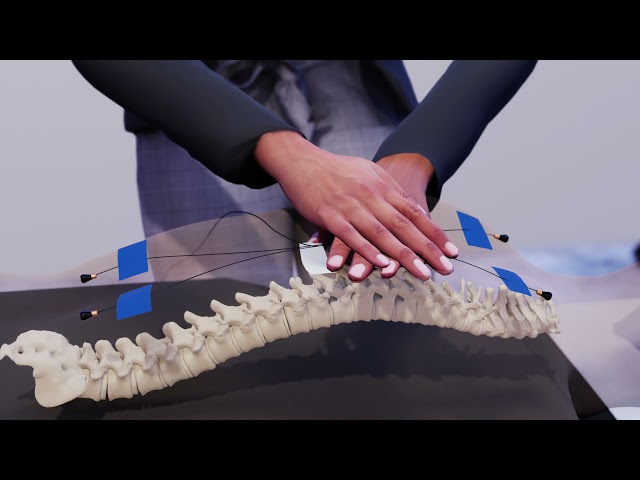 3D medical animation of an Accelerometer