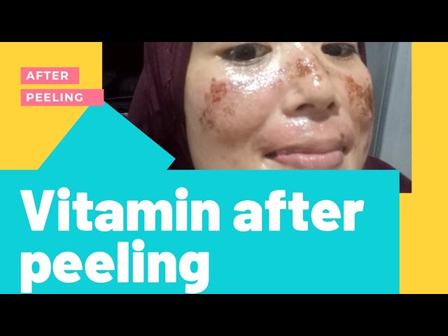 memberikan vitamin after peeling