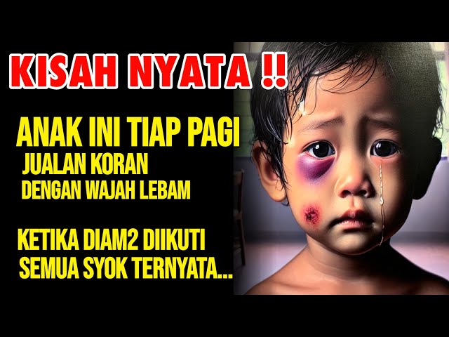 KISAH NYATA !! Anak Ini Tiap Pagi Jualan Koran Dengan Wajah L3bam, Diam2 Diikuti Syok Ternyata