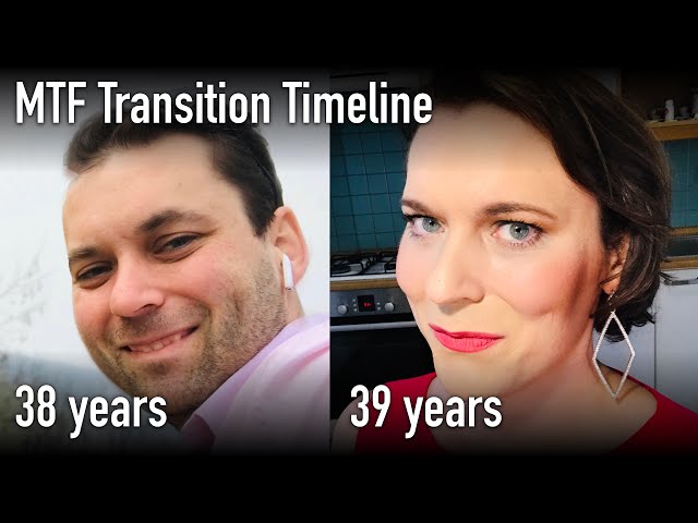 MTF Transition Timeline - 1 year on HRT, just before turning 40 - Lenka