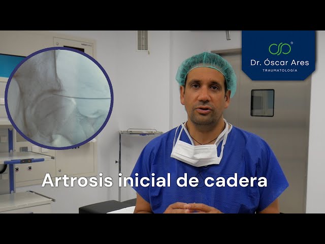 Artrosis inicial de cadera - Dr. Oscar Ares