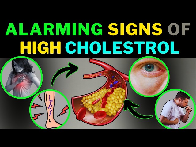 Signs Your Cholesterol is Too High!