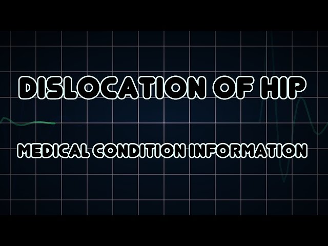 Dislocation of hip (Medical Condition)