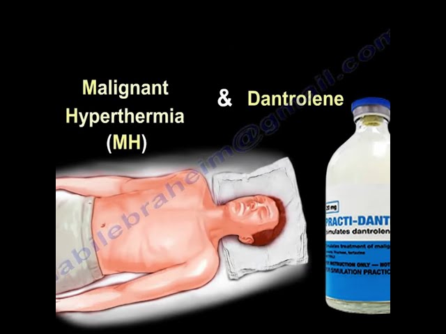 Malignant Hyperthermia