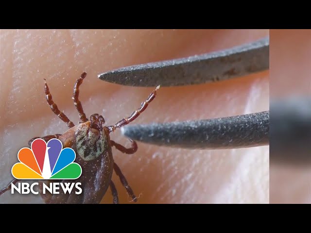 New research may reveal why Lyme disease causes chronic symptoms for some