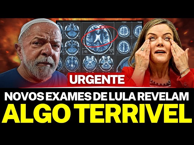 URGENTE! NOVOS EXAMES DE LULA, REVELAM ALGO TERRÍVEL!