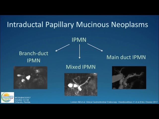 Approach to Cystic Lesions of the Pancreas