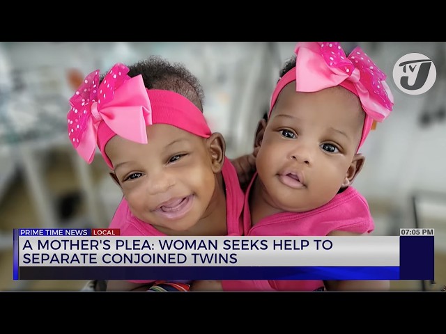 A Mother's Plea: Woman Seeks help to Separate Conjoined Twins | TVJ News