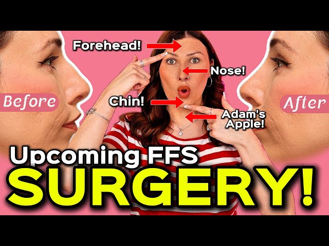 These are the SURGERIES I'm getting done for my FFS! | MTF Transgender Surgery Journey