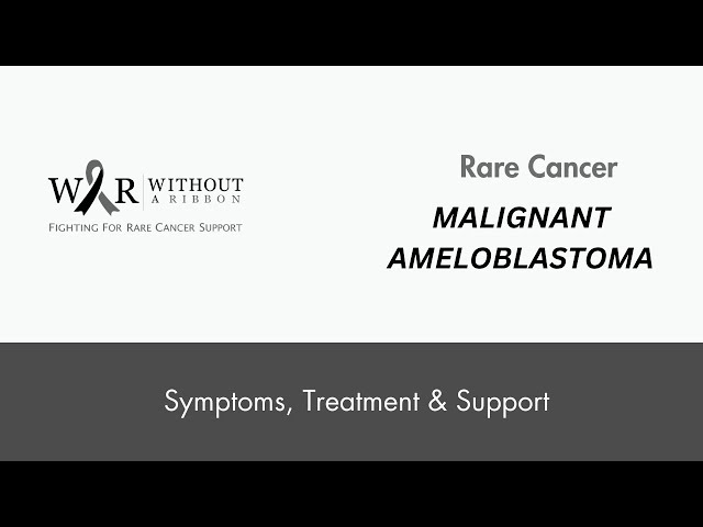 Malignant Ameloblastoma