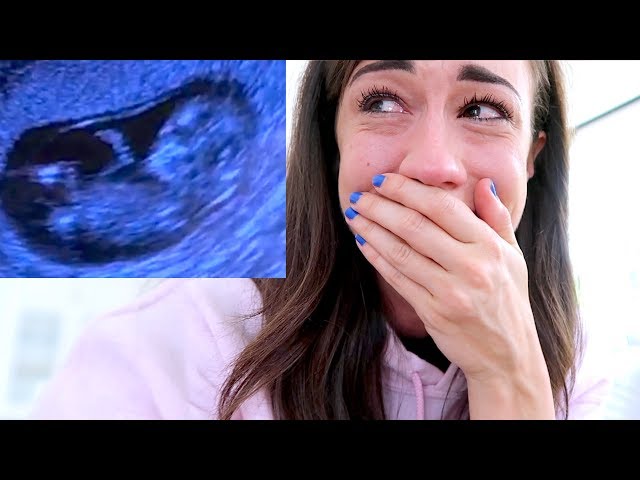 MY FIRST ULTRASOUND! *EMOTIONAL*