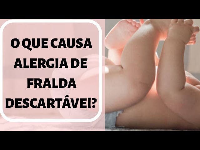 Entenda qual é a causa das alergias de FRALDAS DESCARTÁVEIS