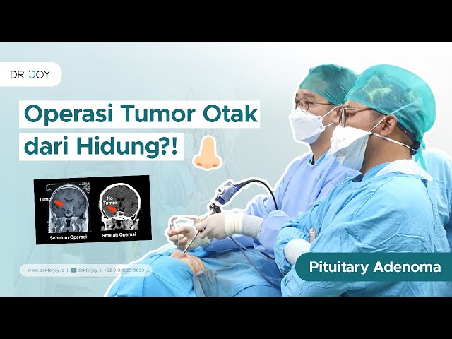 Operasi tumor otak tanpa sayatan sama sekali di kepala? | Cerita Tumor Otak #12