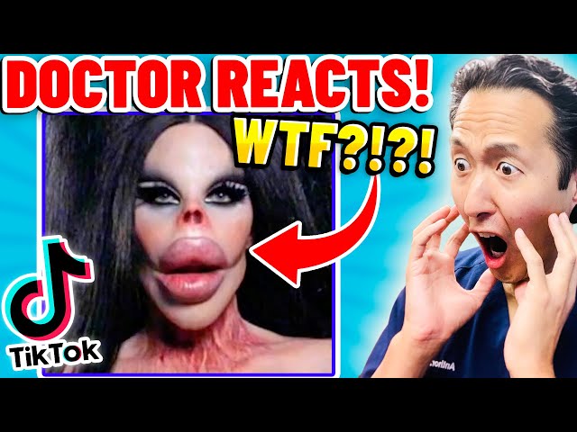 Plastic Surgeon Reacts to BOTCHED Plastic Surgery TikTok Videos!