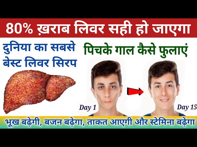 लिवर का दुनिया का सबसे बेस्ट सिरप || 80% ख़राब लिवर को भी ठीक कर देगा || liver syrup best | liver