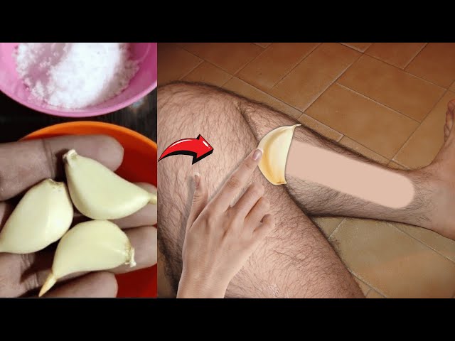 Stop shaving! Here's how to get rid permanently facial, body and pubic hair at home.