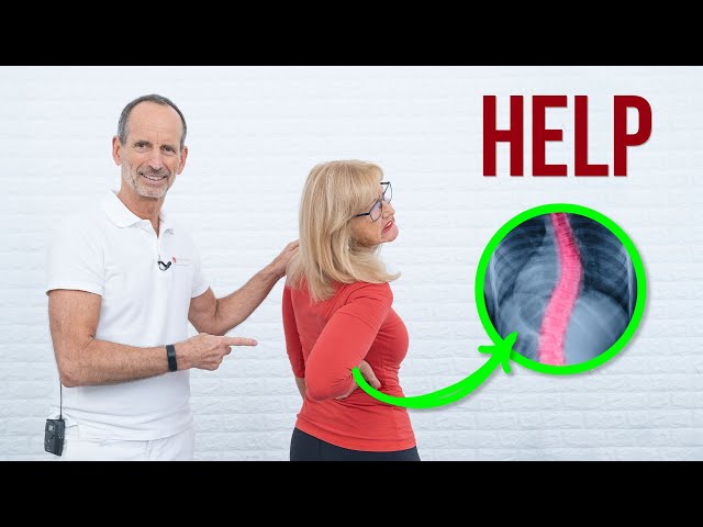 Treat Scoliosis At Home (Best Stretches)