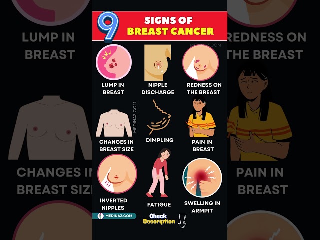 Breast Cancer :10 Warning Signs Every Woman Must Know ✅