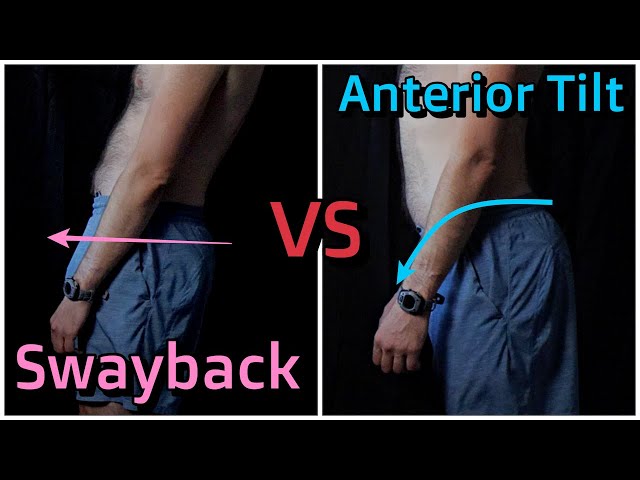 Anterior Pelvic Tilt vs Swayback - What's the Difference?