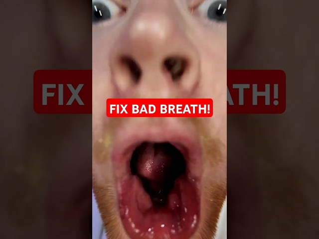 #1 MISTAKE THAT CAUSES BAD BREATRH! #dentist #badbreath #health #oralhealth #viralshorts #foryou