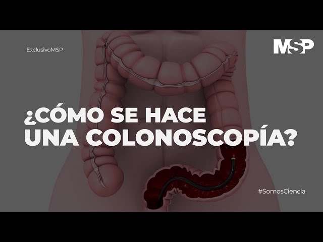 ¿Cómo se hace una colonoscopía? #ExclusivoMSP