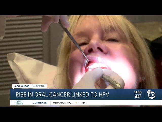 Rise in oral cancer linked to HPV