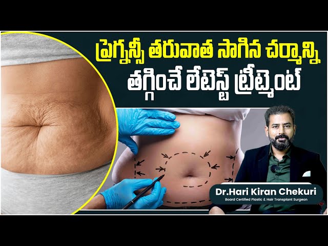 How to Tighten Loose Skin After Pregnancy || How to Get Rid of Saggy Belly Skin || ReDefine Channel