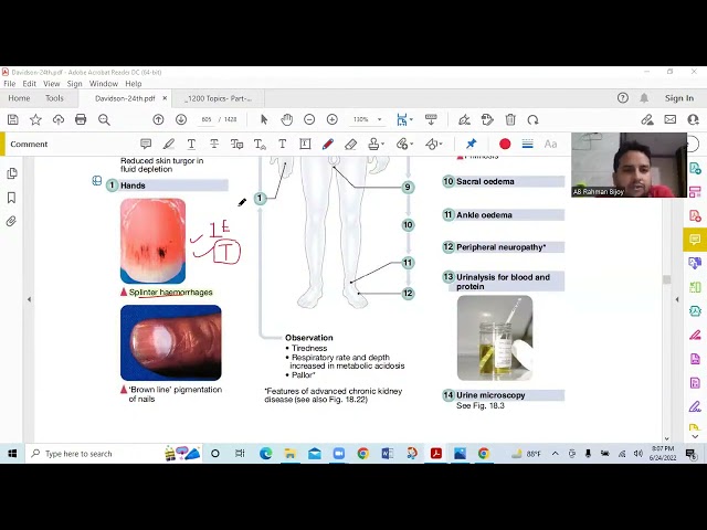 Nephrology & Urology -Davidson's Principles and Practice of Medicine | FCPS | MRCP| MD | Lecture 01