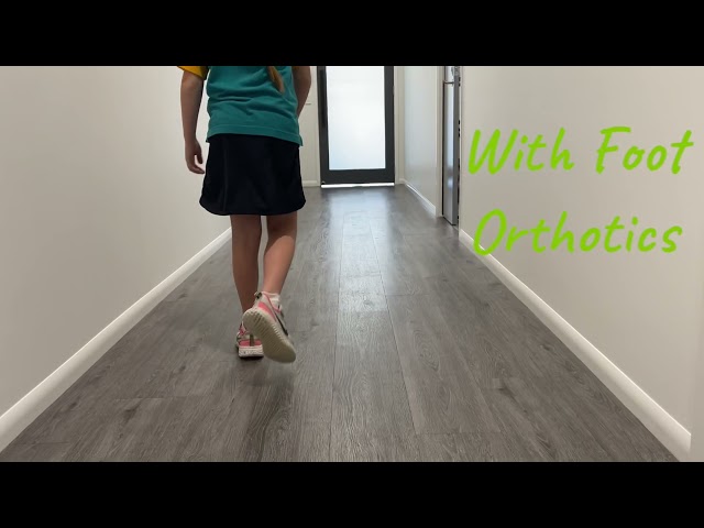 Tip Toe Walking in Children (Idiopathic Toe Walking)